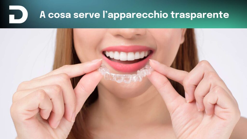 a cosa serve l'apparecchio trasparente | dentalian