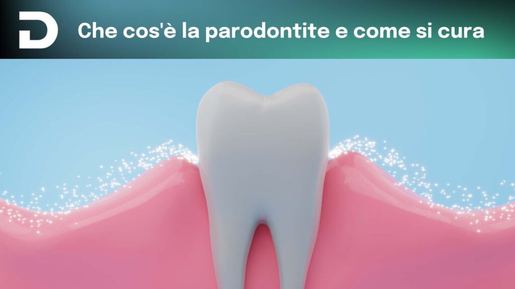 che cos'è la parodontite e come si cura | dentalian