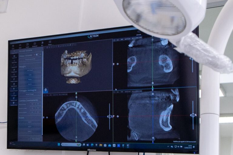 rischi impianti dentali