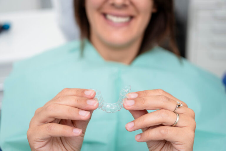 come funzionano le mascherine per i denti
