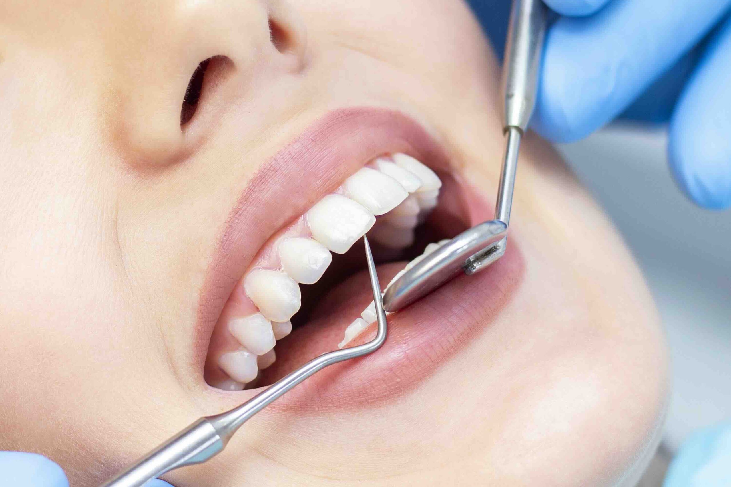 Prima visita dentista