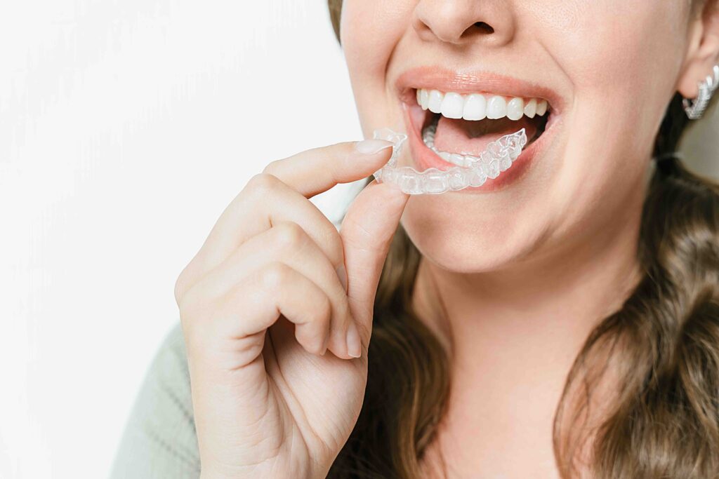 Come togliere la mascherina denti