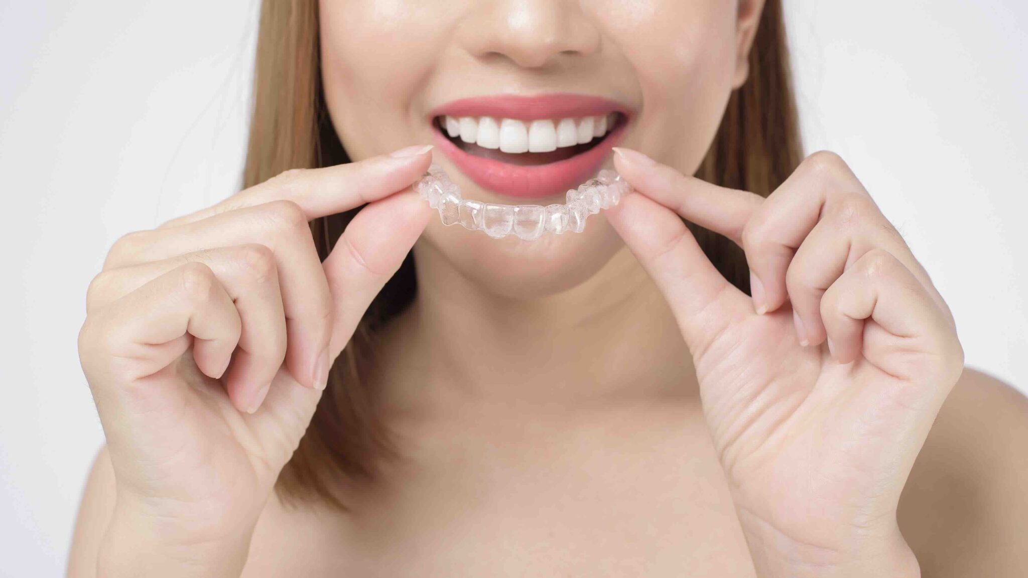 quanto costano le mascherine per i denti
