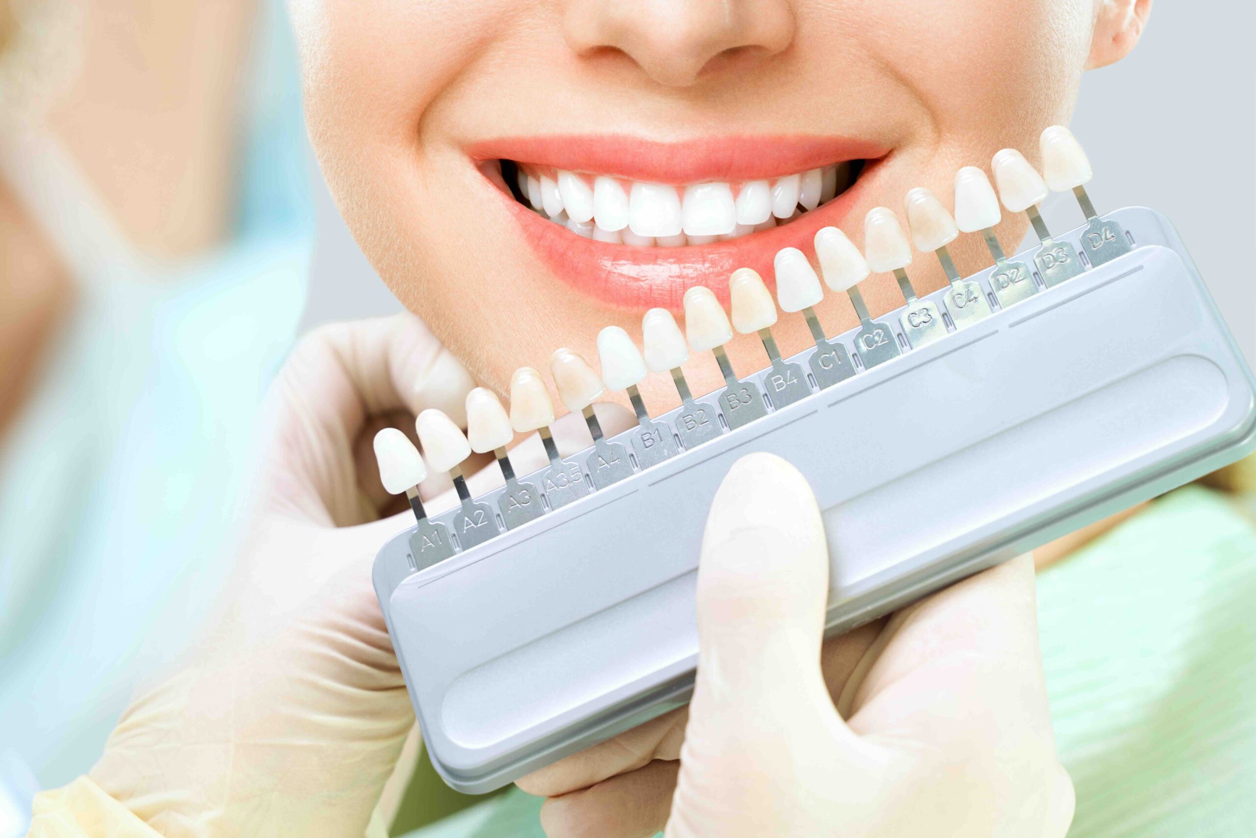 Mangiare cibi duri con le faccette