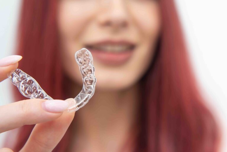 Come pulire le mascherine per i denti