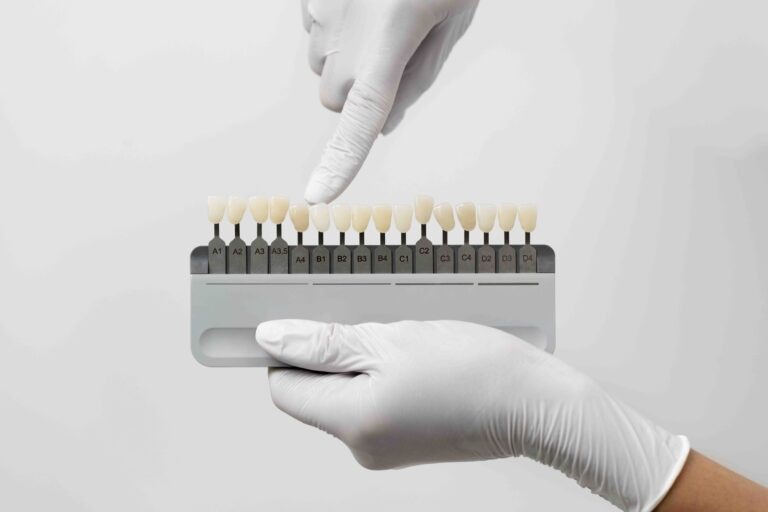 Quali bevande macchiano di più i denti