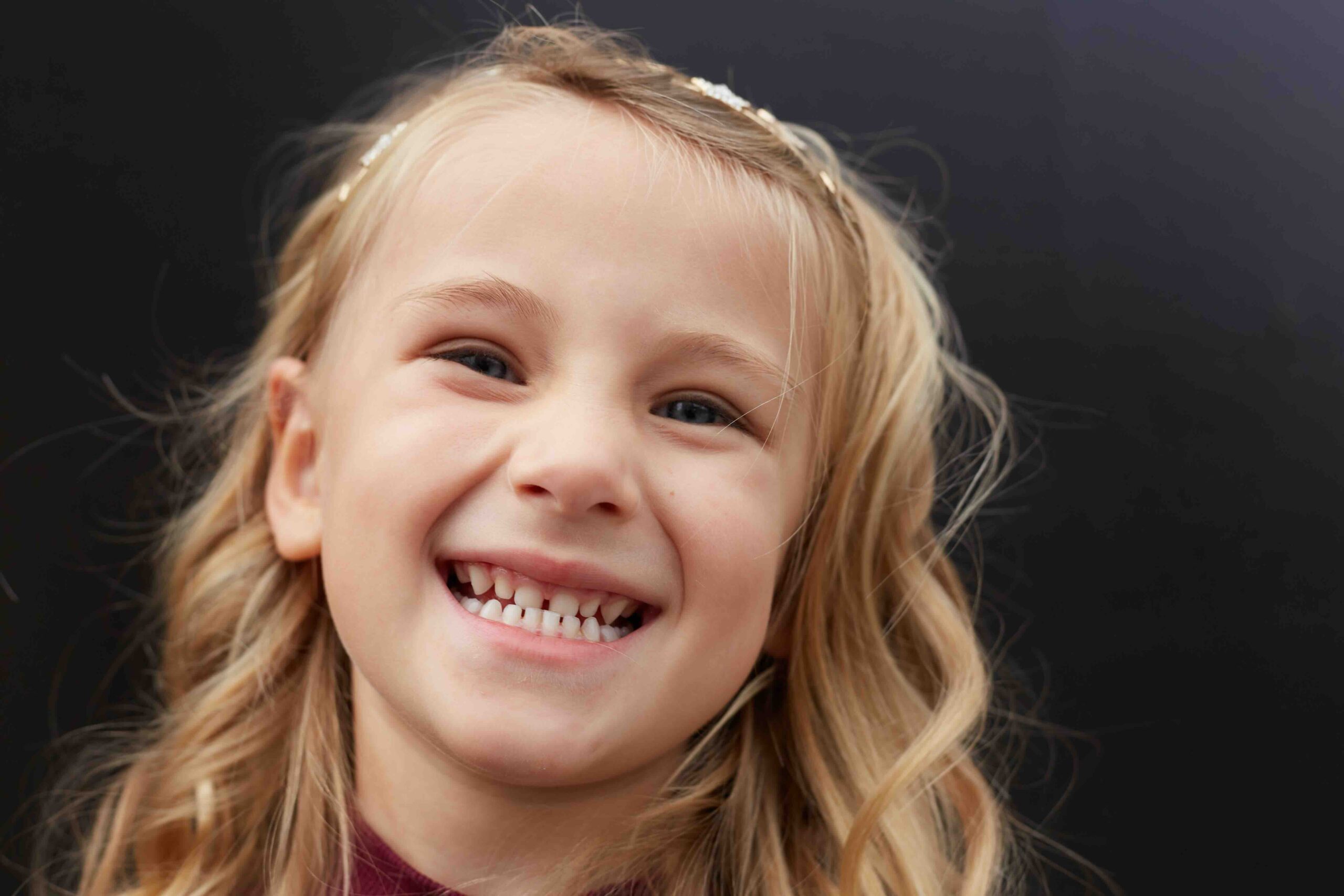 Quali sono i denti che cadono per primi