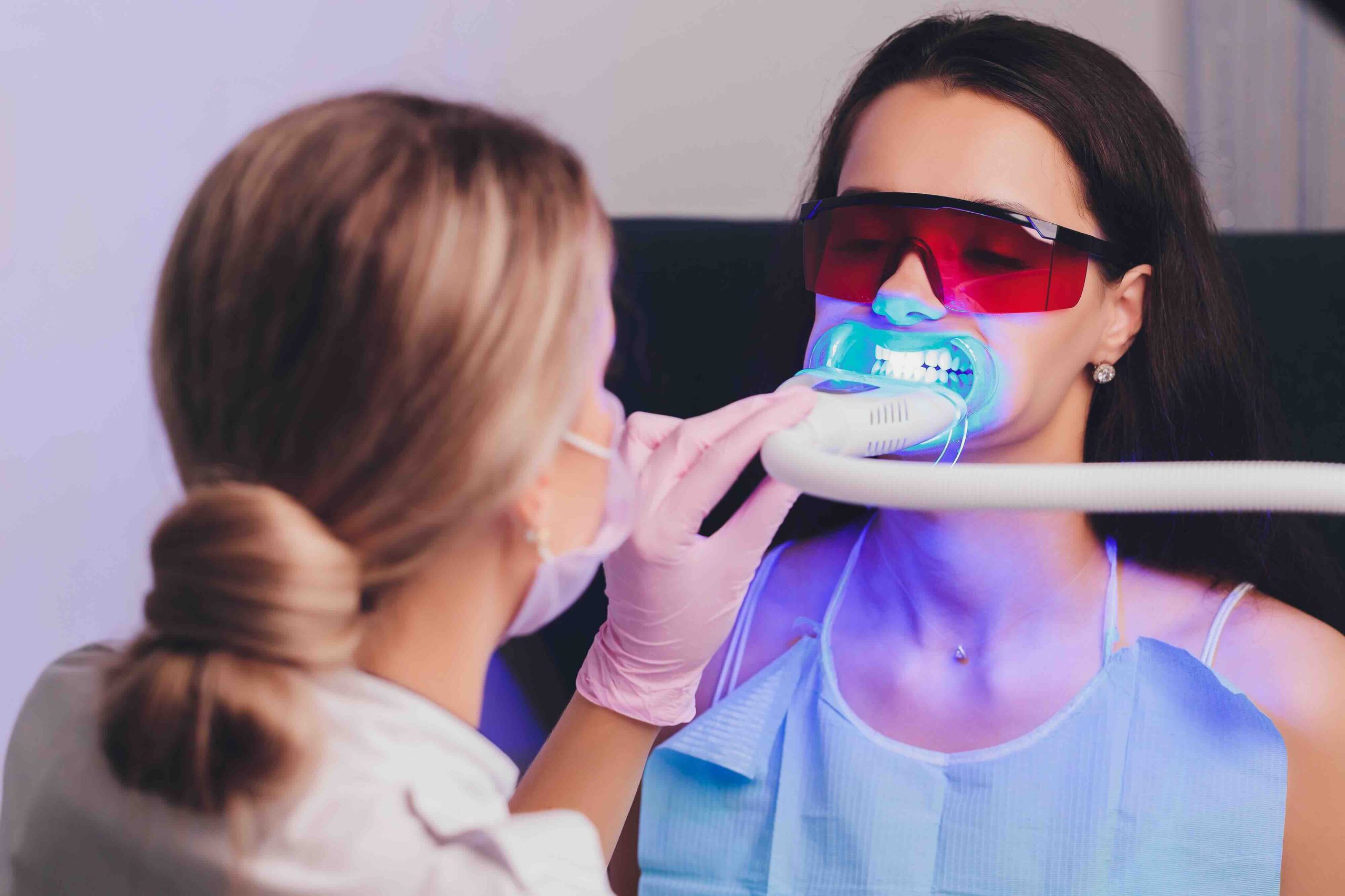 Sbiancamento dentale quando serve più di una seduta