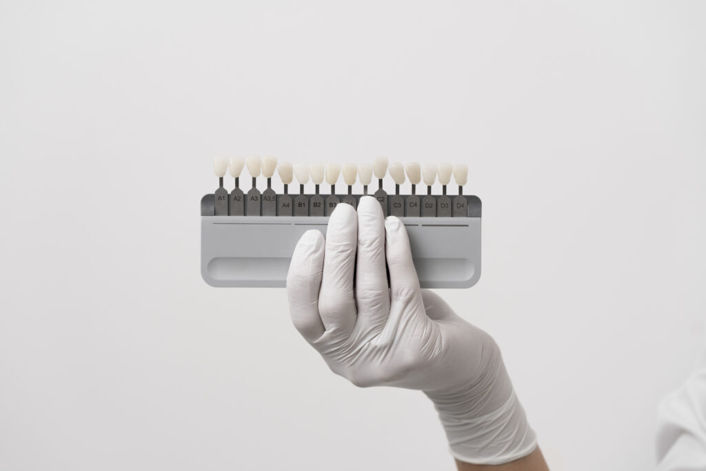 doloroso togliere le faccette dentali