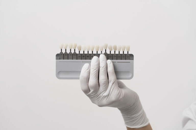 doloroso togliere le faccette dentali